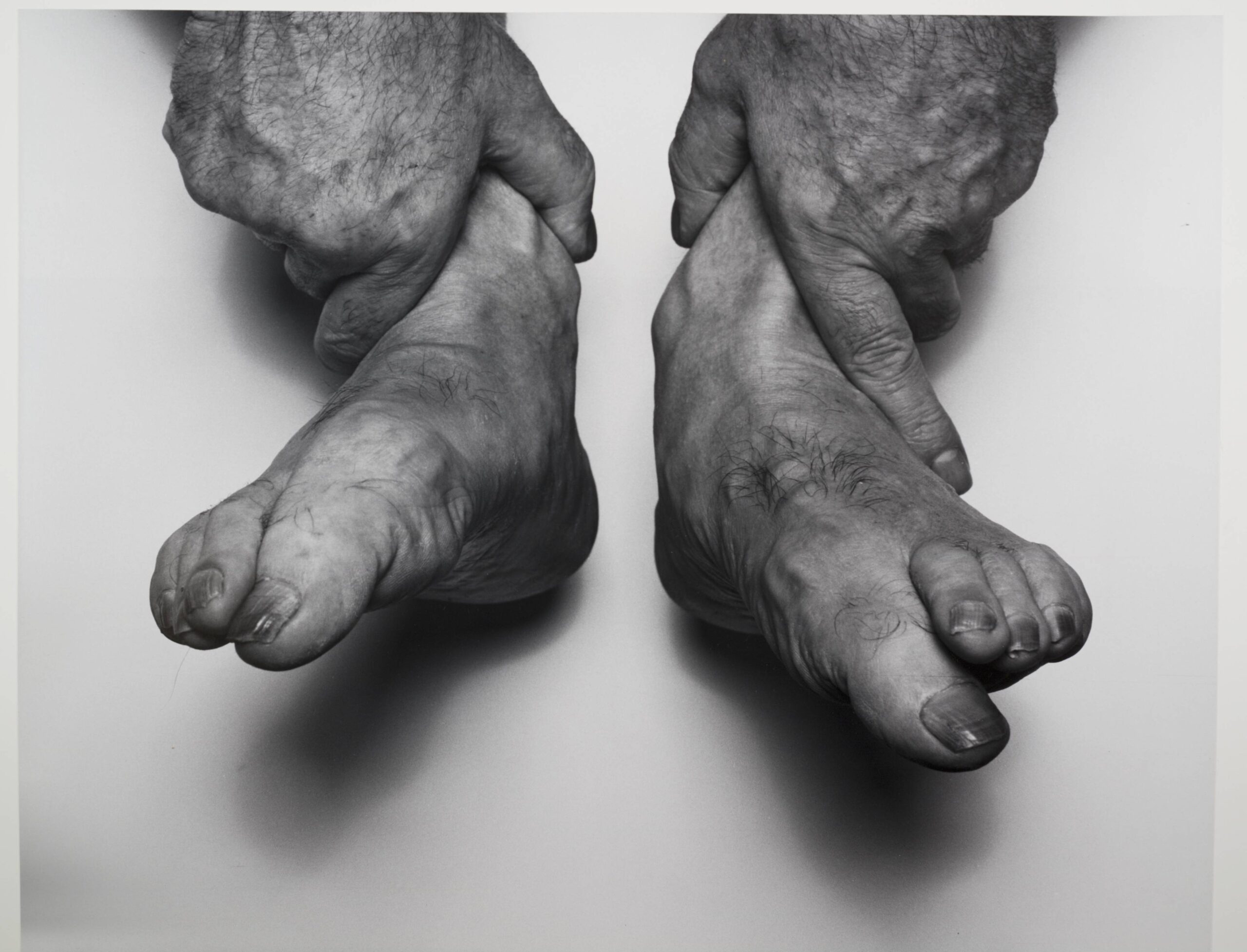 John Coplans, Self-Portrait (Hands Holding Feet), 1985 · SFMOMA